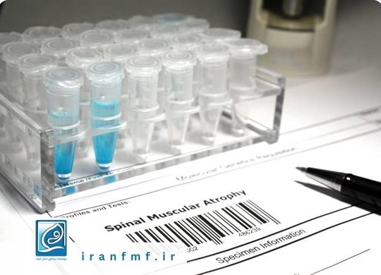 بیماری آتروفی عضلانی نخاعی SMA و برنامه ملی غربالگری